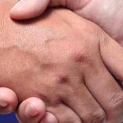 Business Networks for Restoration and Remodeling professionals Image